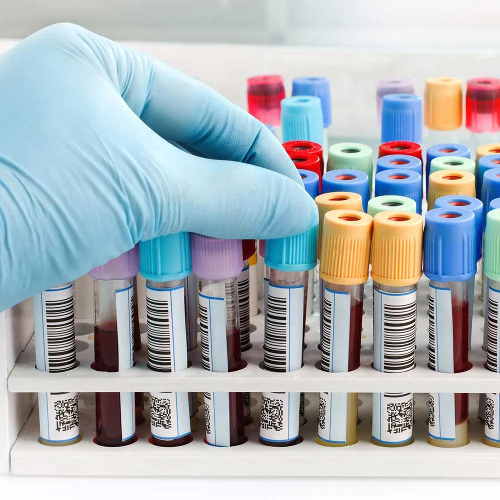 laboratory labels